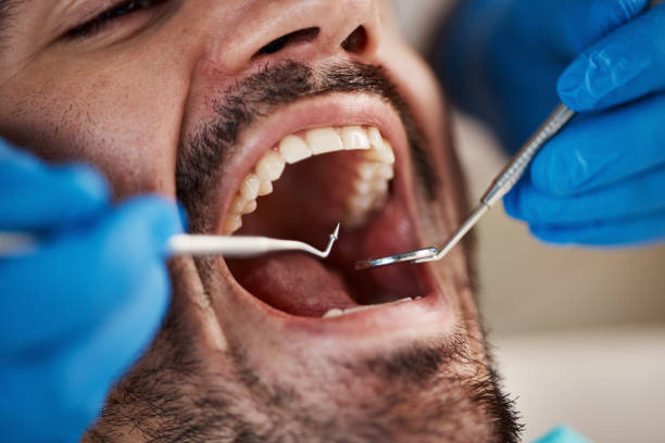 Best Dentist for Tooth Abscess  in Antlers, OK